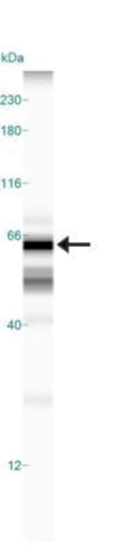 Invitrogen TOM70 Polyclonal Antibody 100 &mu;L; Unconjugated:Antibodies,