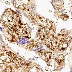 Invitrogen YAP1 Polyclonal Antibody 100 &mu;L; Unconjugated:Antibodies,