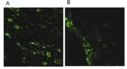 Invitrogen LRRK2 Polyclonal Antibody 100 &mu;L; Unconjugated:Antibodies,