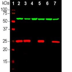 Invitrogen PGP9.5 Polyclonal Antibody 100 &mu;L | Buy Online | Invitrogen&trade; | Fisher Scientific