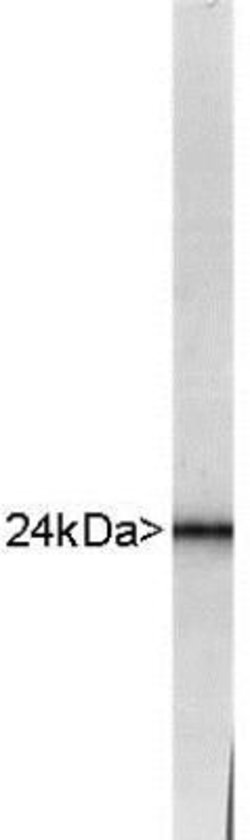 Invitrogen PGP9.5 Polyclonal Antibody 100 &mu;L | Buy Online | Invitrogen&trade; | Fisher Scientific