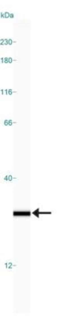 Invitrogen PGP9.5 Polyclonal Antibody 100 &mu;L | Buy Online | Invitrogen&trade; | Fisher Scientific