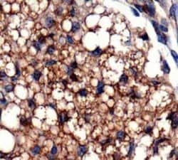 Invitrogen OXPAT Polyclonal Antibody 100 &mu;L; Unconjugated:Antibodies,