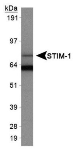 Invitrogen STIM1 Polyclonal Antibody 100 &mu;L; Unconjugated:Antibodies,