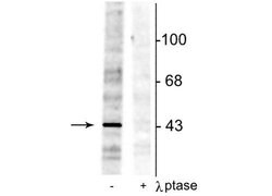 Invitrogen Phospho-EphB2 (Tyr298) Polyclonal Antibody 100 &mu;L; Unconjugated:Antibodies,