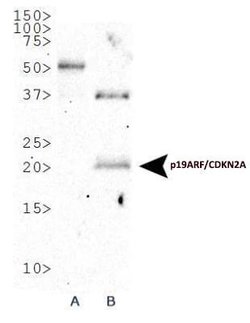 Invitrogen p16INK4a Polyclonal Antibody 100 &mu;L; Unconjugated:Antibodies,