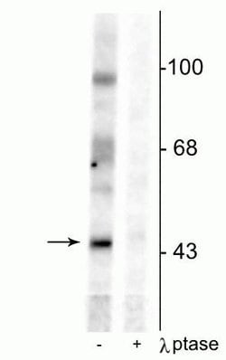 Invitrogen Phospho-EphB2 (Tyr331) Polyclonal Antibody 100 &mu;L; Unconjugated:Antibodies,