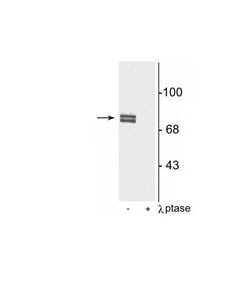 Invitrogen Phospho-ALOX5 (Ser523) Polyclonal Antibody 100 &mu;L; Unconjugated:Antibodies,