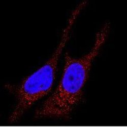 Invitrogen LC3B Polyclonal Antibody 100 &mu;L | Buy Online | Invitrogen&trade; | Fisher Scientific
