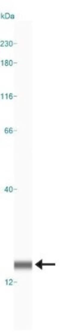 Invitrogen LC3B Polyclonal Antibody 100 &mu;L | Buy Online | Invitrogen&trade; | Fisher Scientific
