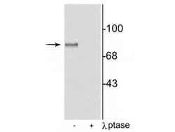 Invitrogen Phospho-MARCKS (Ser152, Ser156) Polyclonal Antibody 100 &mu;L | Buy Online | Invitrogen&trade; | Fisher Scientific