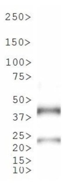 Invitrogen Tet Repressor Polyclonal Antibody 100 &mu;L; Unconjugated:Antibodies,