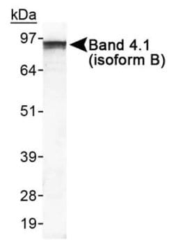 Invitrogen EPB41L3 Polyclonal Antibody 100 &mu;L; Unconjugated:Antibodies,