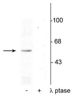 Invitrogen Phospho-p53 (Ser392) Polyclonal Antibody 100 &mu;L | Buy Online | Invitrogen&trade; | Fisher Scientific