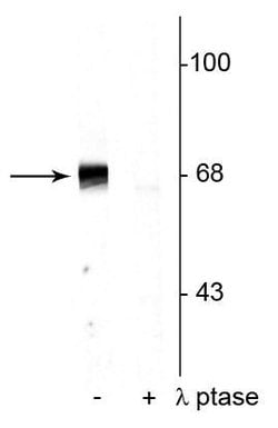 Invitrogen Phospho-PAK1/2/3 (Thr402) Polyclonal Antibody 100 &mu;L | Buy Online | Invitrogen&trade; | Fisher Scientific