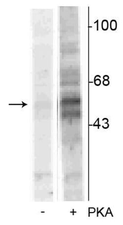 Invitrogen Phospho-TPH1 (Ser58) Polyclonal Antibody 100 &mu;L; Unconjugated:Antibodies,