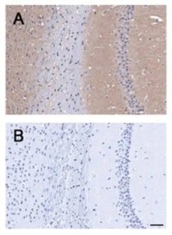 Invitrogen BAI1 Polyclonal Antibody 100 &mu;L; Unconjugated:Antibodies,