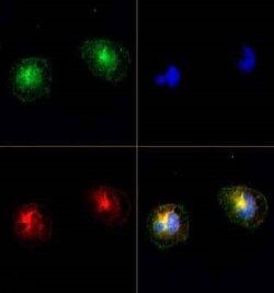 Invitrogen TRPM2 Polyclonal Antibody 100 &mu;L | Buy Online | Invitrogen&trade; | Fisher Scientific