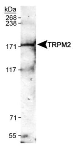Invitrogen TRPM2 Polyclonal Antibody 100 &mu;L; Unconjugated:Antibodies,