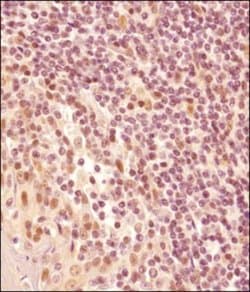 Invitrogen LMO2 Polyclonal Antibody 100 &mu;L | Buy Online | Invitrogen&trade; | Fisher Scientific