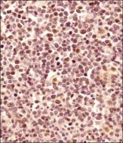 Invitrogen LMO2 Polyclonal Antibody 100 &mu;L | Buy Online | Invitrogen&trade; | Fisher Scientific