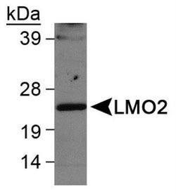 Invitrogen LMO2 Polyclonal Antibody 100 &mu;L | Buy Online | Invitrogen&trade; | Fisher Scientific