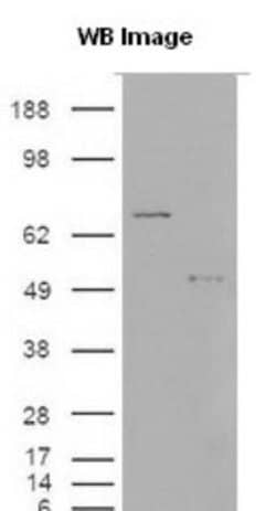S100A9 Polyclonal Antibody:Antibodies, Polyclonal