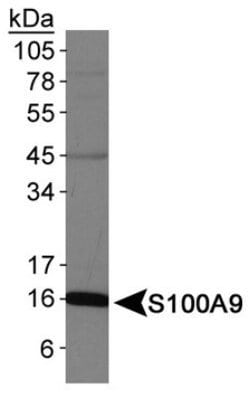 S100A9 Polyclonal Antibody:Antibodies, Polyclonal