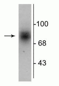 Invitrogen™ Dopamine Transporter Polyclonal Antibody