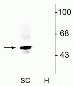 Invitrogen GLRA1 Polyclonal Antibody 200 &mu;g; Unconjugated:Antibodies,
