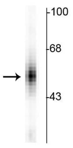 Invitrogen TPH1 Polyclonal Antibody 100 &mu;L; Unconjugated:Antibodies,