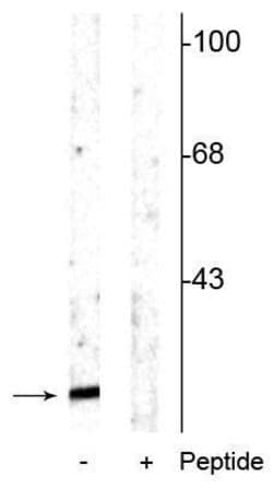Invitrogen Phospho-alpha Synuclein (Ser129) Polyclonal Antibody 100 &mu;L;