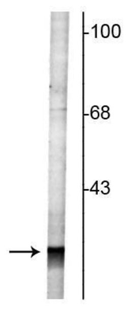 Invitrogen RAB3a Polyclonal Antibody 100 &mu;L; Unconjugated:Antibodies,