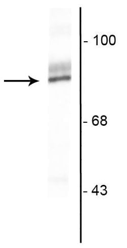 Invitrogen RSK3 Polyclonal Antibody 100 &mu;L | Buy Online | Invitrogen&trade; | Fisher Scientific