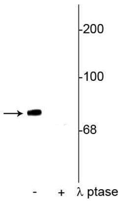 Invitrogen Phospho-Synapsin 1 (Ser549) Polyclonal Antibody 100 &mu;L; Unconjugated:Antibodies,