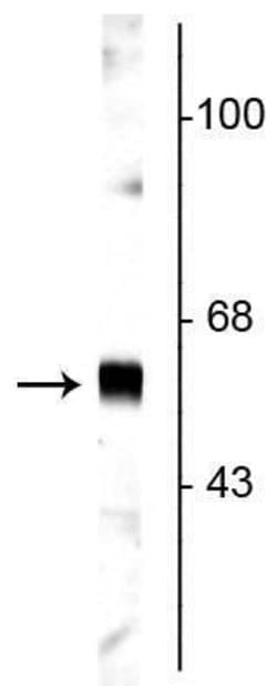 Invitrogen Synaptotagmin 1 Polyclonal Antibody 100 &mu;L | Buy Online | Invitrogen&trade; | Fisher Scientific