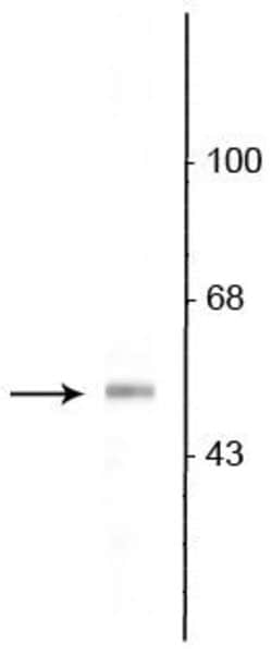 Invitrogen VGAT Polyclonal Antibody 100 &mu;L; Unconjugated:Antibodies,