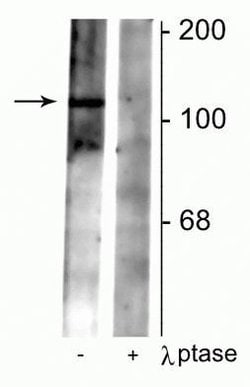 Invitrogen Phospho-GABBR2 (Ser783) Polyclonal Antibody 100 &mu;L | Buy Online | Invitrogen&trade; | Fisher Scientific