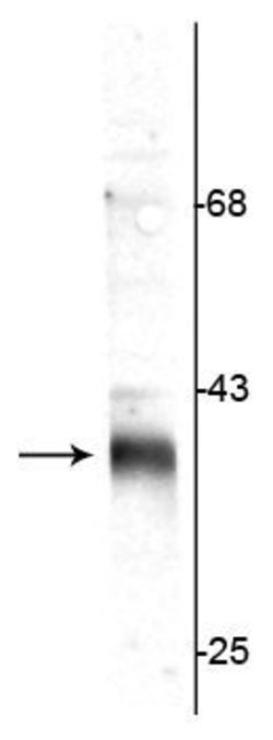 Invitrogen Stargazin Polyclonal Antibody 100 &mu;L; Unconjugated:Antibodies,