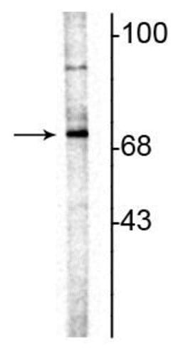Invitrogen ChAT Polyclonal Antibody 100 &mu;L; Unconjugated:Antibodies,