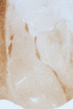 Invitrogen GABRA3 Polyclonal Antibody 100 &mu;L; Unconjugated:Antibodies,