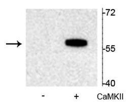 Invitrogen Phospho-TPH2 (Ser19) Polyclonal Antibody 100 &mu;L; Unconjugated:Antibodies,