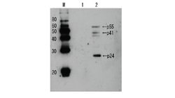 Invitrogen HIV1 p24 Polyclonal Antibody 100 &mu;L; Unconjugated:Antibodies,