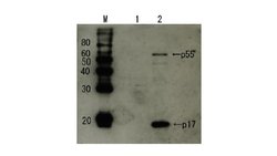 Invitrogen HIV1 p17 Polyclonal Antibody 100 &mu;L; Unconjugated:Antibodies,