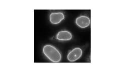 Invitrogen RANBP2 Polyclonal Antibody 100 &mu;L | Buy Online | Invitrogen&trade; | Fisher Scientific