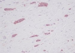Invitrogen CCL5 (RANTES) Polyclonal Antibody 100 &mu;g; Unconjugated:Antibodies,