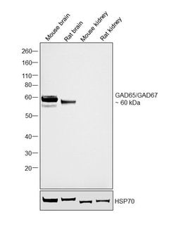 Invitrogen GAD65/GAD67 Polyclonal Antibody 100 &mu;L; Unconjugated:Antibodies,