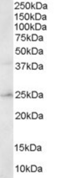 Invitrogen ERAB Polyclonal Antibody 100 &mu;g; Unconjugated:Antibodies,