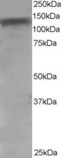 Invitrogen ADAM17 Polyclonal Antibody 100 &mu;g; Unconjugated:Antibodies,