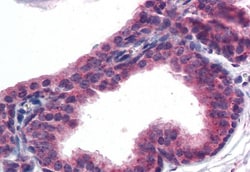 Invitrogen AKT3 Polyclonal Antibody 100 &mu;g; Unconjugated:Antibodies,
